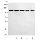 Western blot testing of 1) human HeLa, 2) human K562, 3) human 293T, 4) rat C6 and 5) mouse NIH 3T3 cell lysate with PRPF6 antibody. Predicted molecular weight ~107 kDa.