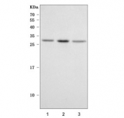 Western blot testing of human 1) HepG2, 2) A431 and 3) PC-3 cell lysate with PRRG1 antibody. Predicted molecular weight ~25 kDa.