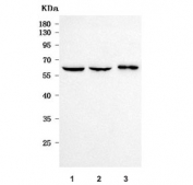 Western blot testing of human 1) PC-3, 2) SiHa and 3) A431 cell lysate with PPP2R5B antibody. Predicted molecular weight ~57 kDa.