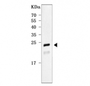 Western blot testing of human SH-SY5Y cell lysate with RAB39A/B antibody. Predicted molecular weight ~25 kDa with a possible RAB39A cleavage band also being observed.