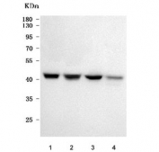 Western blot testing of human 1) HeLa, 2) RT4, 3) U-251 and 4) Jurkat cell lysate with PSMD6 antibody. Predicted molecular weight: 41-52 kDa (multiple isoforms).