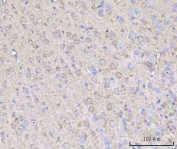 IHC staining of FFPE mouse brain tissue with Rabphilin 3A antibody. HIER: boil tissue sections in pH8 EDTA for 20 min and allow to cool before testing.