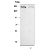 Western blot testing of human 1) K562 and 2) SiHa cell lysate with CEP164 antibody. Predicted molecular weight ~164 kDa.