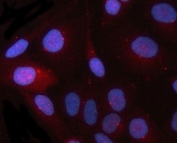 Immunofluorescent staining of FFPE human HeLa cells with CEP164 antibody (red) and DAPI nuclear stain (blue). HIER: steam section in pH6 citrate buffer for 20 min.