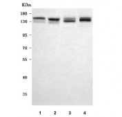 Western blot testing of 1) human RT4, 2) human SH-SY5Y, 3) rat brain and 4) mouse brain tissue lysate with PSD3 antibody. Predicted molecular weight ~116 kDa (multiple isoforms).
