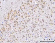 IHC staining of FFPE rat brain tissue with PPWD1 antibody. HIER: boil tissue sections in pH8 EDTA for 20 min and allow to cool before testing.