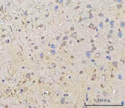 IHC staining of FFPE mouse brain tissue with PPWD1 antibody. HIER: boil tissue sections in pH8 EDTA for 20 min and allow to cool before testing.