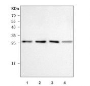 Western blot testing of 1) human MCF7, 2) rat brain, 3) mouse brain and 4) mouse lung tissue lysate with TTC9 antibody. Predicted molecular weight ~24 kDa.
