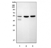 Western blot testing of 1) human K562, 2) rat brain and 3) mouse brain tissue lysate with NARF antibody. Predicted molecular weight: 45-56 kDa (multiple isoforms).