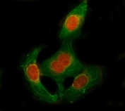 Immunofluorescent staining of FFPE human U-2 OS cells with PA26 antibody (red) and Beta Tubulin mAb (green). HIER: steam section in pH6 citrate buffer for 20 min.