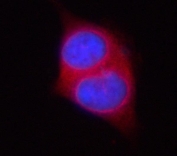 Immunofluorescent staining of FFPE human PC-3 cells with Phosphoserine aminotransferase antibody (red) and DAPI nuclear stain (blue). HIER: steam section in pH6 citrate buffer for 20 min.