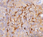 IHC staining of FFPE human tonsil tissue with TRNT1 antibody. HIER: boil tissue sections in pH8 EDTA for 20 min and allow to cool before testing.