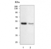 Western blot testing of human 1) MCF7 and 2) HeLa cell lysate with TRNT1 antibody. Predicted molecular weight ~50 kDa.