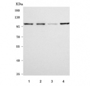 Western blot testing of 1) human HeLa, 2) human HepG2, 3) rat PC-12 and 4) mouse LLC cell lysate with ROBO4 antibody. Predicted molecular weight: 75-107 kDa (multiple isoforms), but may be observed at higher molecular weights due to glycosylation.