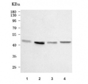 Western blot testing of human 1) A431, 2) PC-3, 3) SiHa and 4) A549 cell lysate with AADACL1 antibody. Predicted molecular weight ~46 kDa.
