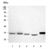 Western blot testing of 1) human HCCT, 2) human HCCP, 3) rat liver, 4) rat RH35 and 5) mouse liver tissue lysate with PBLD antibody. Predicted molecular weight ~32 kDa.