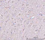 IHC staining of FFPE rat brain tissue with NECAB1 antibody. HIER: boil tissue sections in pH8 EDTA for 20 min and allow to cool before testing.