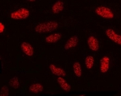 Immunofluorescent staining of FFPE human U-2 OS cells with NECAB1 antibody (red). HIER: steam section in pH6 citrate buffer for 20 min.