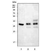Western blot testing of 1) human 293T, 2) rat brain and 3) mouse brain tissue lysate with NDRG4 antibody. Predicted molecular weight: 37-43 kDa (multiple isoforms).
