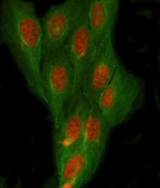 Immunofluorescent staining of FFPE human U-2 OS cells with NDRG4 antibody (red) and Beta Tubulin mAb (green). HIER: steam section in pH6 citrate buffer for 20 min.
