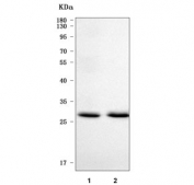 Western blot testing of human 1) HCCT and 2) HCCP cell lysate with PPP1R3B antibody. Predicted molecular weight ~33 kDa.