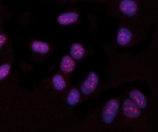 Immunofluorescent staining of FFPE human U-2 OS cells with PYROXD1 antibody (red) and DAPI nuclear stain (blue). HIER: steam section in pH6 citrate buffer for 20 min.