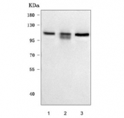 Western blot testing of human 1) 293T, 2) MCF7 and 3) HeLa cell lysate with Protein phosphatase 1 regulatory subunit 15B antibody. Predicted molecular weight ~79 kDa but may be observed at up to ~100 kDa, possibly due to phosphorylation.