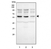 Western blot testing of human 1) 293T, 2) HepG2 and 3) HeLa cell lysate with NAPRT antibody. Predicted molecular weight: 56-60 kDa (multiple isoforms).