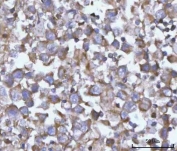 IHC staining of FFPE human testicular seminoma tissue with NANP antibody. HIER: boil tissue sections in pH8 EDTA for 20 min and allow to cool before testing.