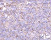 IHC staining of FFPE human tonsil tissue with NANP antibody. HIER: boil tissue sections in pH8 EDTA for 20 min and allow to cool before testing.