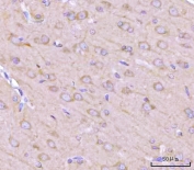IHC staining of FFPE human rat brain tissue with NANP antibody. HIER: boil tissue sections in pH8 EDTA for 20 min and allow to cool before testing.