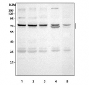 Western blot testing of 1) human 293T, 2) human Raji, 3) human K562, 4) rat testis and 5) mouse testis tissue lysate with TTC39B antibody. Predicted molecular weight: 59-77 kDa, ~23 kDa (multiple isoforms).
