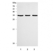 Western blot testing of human 1) Jurkat, 2) SY-SY5Y and 3) K562 cell lysate with C7orf47 antibody. Predicted molecular weight ~28 kDa.