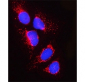 Immunofluorescent staining of FFPE human U-2 OS cells with PPM1J antibody (red) and DAPI nuclear stain (blue). HIER: steam section in pH6 citrate buffer for 20 min.