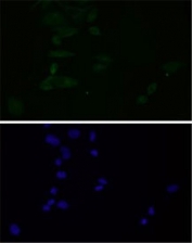 Immunofluorescent staining of FFPE human HeLa cells with Clathrin heavy chain antibody (green) and DAPI nuclear stain (blue). HIER: steam section in pH6 citrate buffer for 20 min.