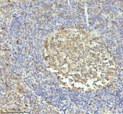 IHC staining of FFPE human tonsil tissue with Caspase-3 antibody. HIER: boil tissue sections in pH8 EDTA for 20 min and allow to cool before testing.