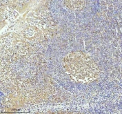 IHC staining of FFPE human tonsil tissue with Caspase-3 antibody. HIER: boil tissue sections in pH8 EDTA for 20 min and allow to cool before testing.
