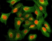 Immunofluorescent staining of FFPE human U-2 OS cells with GLI2 antibody (red) and Beta Tubulin mAb (green). HIER: steam section in pH6 citrate buffer for 20 min.
