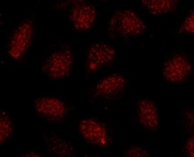 Immunofluorescent staining of FFPE human U-2 OS cells with SOX10 antibody (red). HIER: steam section in pH6 citrate buffer for 20 min.