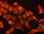 Immunofluorescent staining of FFPE human A549 cells with DAX-1 antibody (red) and Beta Tubulin mAb (green). HIER: steam section in pH6 citrate buffer for 20 min.