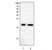 Western blot testing of 1) rat heart and 2) mouse heart tissue lysate with Dtr antibody. Predicted molecular weight ~23 kDa.