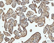 IHC staining of FFPE human placental tissue with Acetyl-CoA acetyltransferase antibody. HIER: boil tissue sections in pH8 EDTA for 20 min and allow to cool before testing.