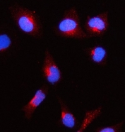 Immunofluorescent staining of FFPE human HeLa cells with Acetyl-CoA acetyltransferase antibody (red) and DAPI nuclear stain (blue). HIER: steam section in pH6 citrate buffer for 20 min.