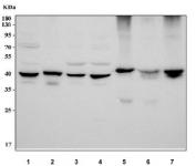 Western blot testing of 1) human HepG2, 2) human PC-3, 3) human A549, 4) human MCF7, 5) rat heart, 6) rat skeletal muscle and 7) mouse heart tissue lysate with Acetyl-CoA acetyltransferase antibody. Predicted molecular weight ~45 kDa.