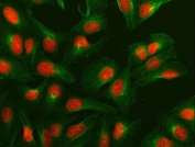 Immunofluorescent staining of FFPE human U-2 OS cells with NUMA1 antibody (red) and Beta Tubulin mAb (green). HIER: steam section in pH6 citrate buffer for 20 min.