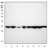 Western blot testing of human 1) HeLa, 2) Jurkat, 3) A431, 4) Ramos, 5) 293T, 6) Caco-2, 7) HEL and 8) SiHa cell lysate with MAPRE1 antibody. Predicted molecular weight ~30 kDa.