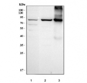 Western blot testing of human 1) K526, 2) A549 and 3) placental tissue lysate with Transglutaminase 2 antibody. Predicted molecular weight ~78 kDa.