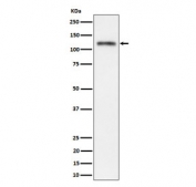 Western blot testing of human SH-SY5Y cell lysate with SEMA4D antibody. Predicted molecular weight ~96 kDa, may be observed at higher molecular weights due to glycosylation.