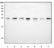 Western blot testing of human 1) A375, 2) 293T, 3) HeLa, 4) K562, 5) Jurkat, 6) ThP-1 and 7) SH-SY5Y cell lysate with MAD2B antibody. Predicted molecular weight ~24 kDa.