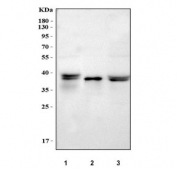 Western blot testing of 1) rat liver, 2) mouse kidney and 3) mouse liver tissue lysate with Ambp antibody. Predicted molecular weight: 26-28 kDa (Alpha 1 microglobulin), ~39 kDa (uncleaved AMBP). These proteins may be observed at higher molecular weights due to glycosylation.